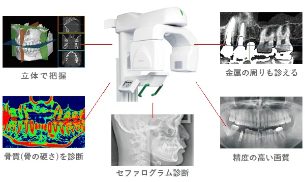 歯科用CT・パノラマレントゲン iCAT RevoluXの機能