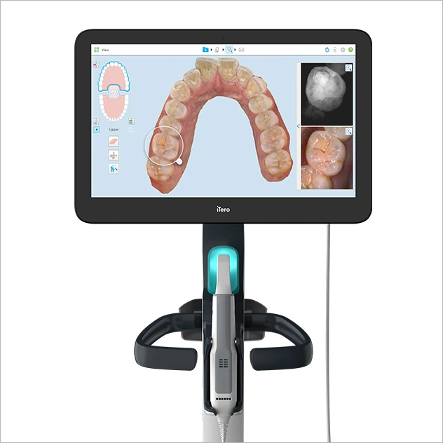 iTero エレメント 5D プラス