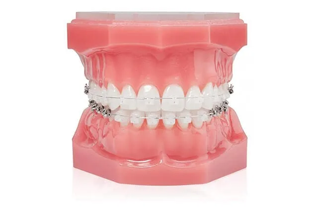 c-bracket