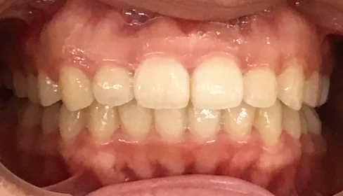 case-ortho_1b