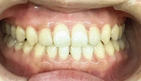 case-ortho_2b