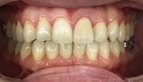 case-ortho_3b