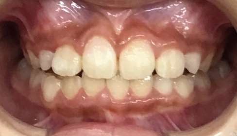 case-ortho_5b