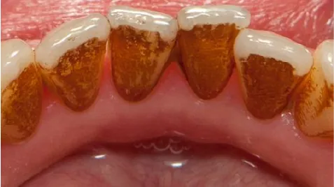 cosmetic-before