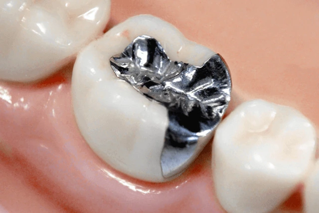 cosmetic-ceramic-3