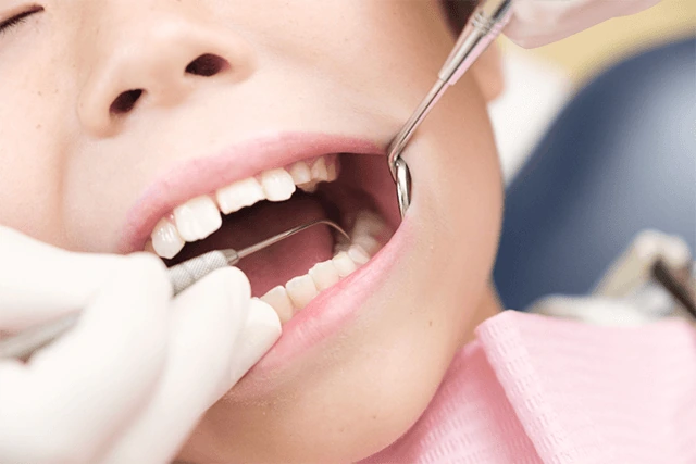 general-caries