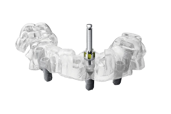 implant-f3