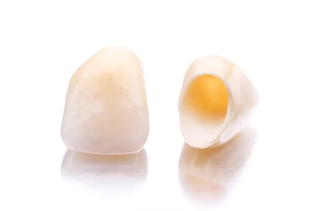 implant-premium-ceramic1