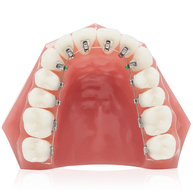 ortho-lingual