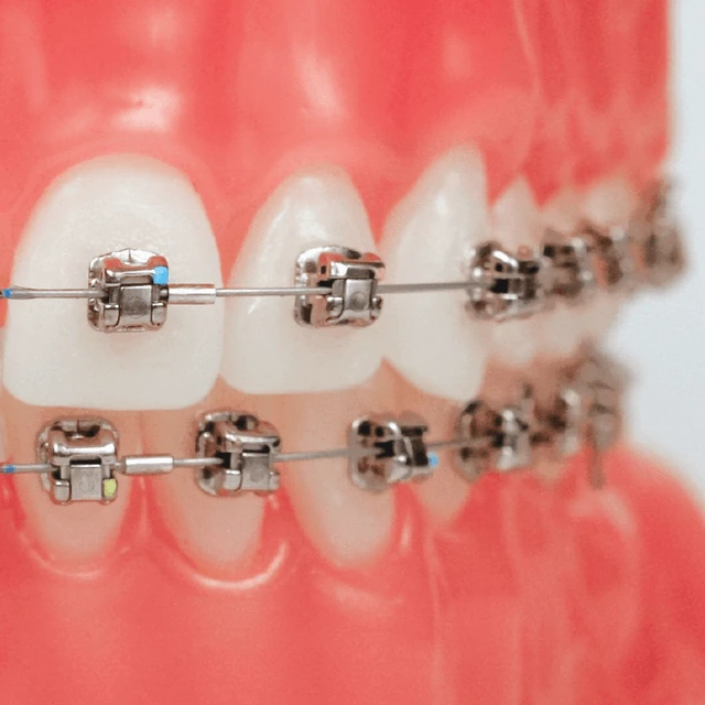 ortho-self-ligation